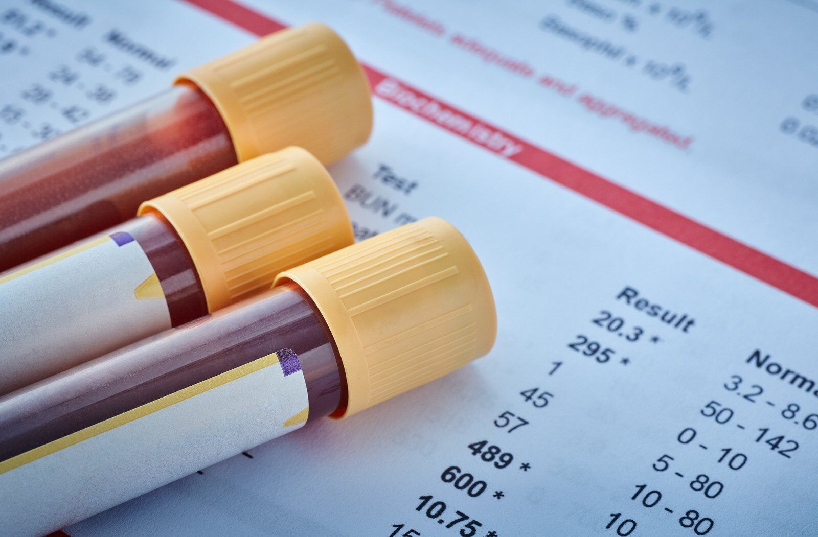 Avenues Recovery explains that blood tests can detect how long tramadol stays in your system. 