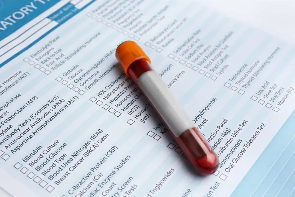 Blood sample on test results page illustrating how Adderall shows up on a drug test