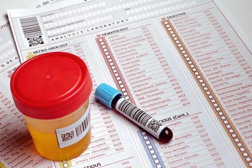 Does Klonopin show up on a drug test? | Avenues Recovery
