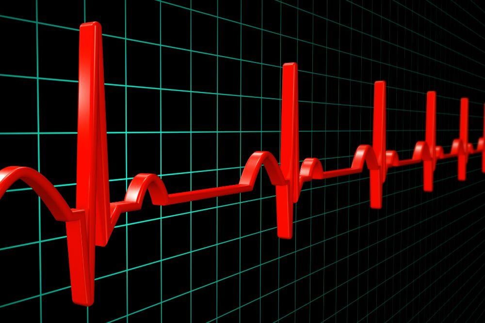 Seroquel abuse can lead to irregular heartbeat, explains Avenues Recovery