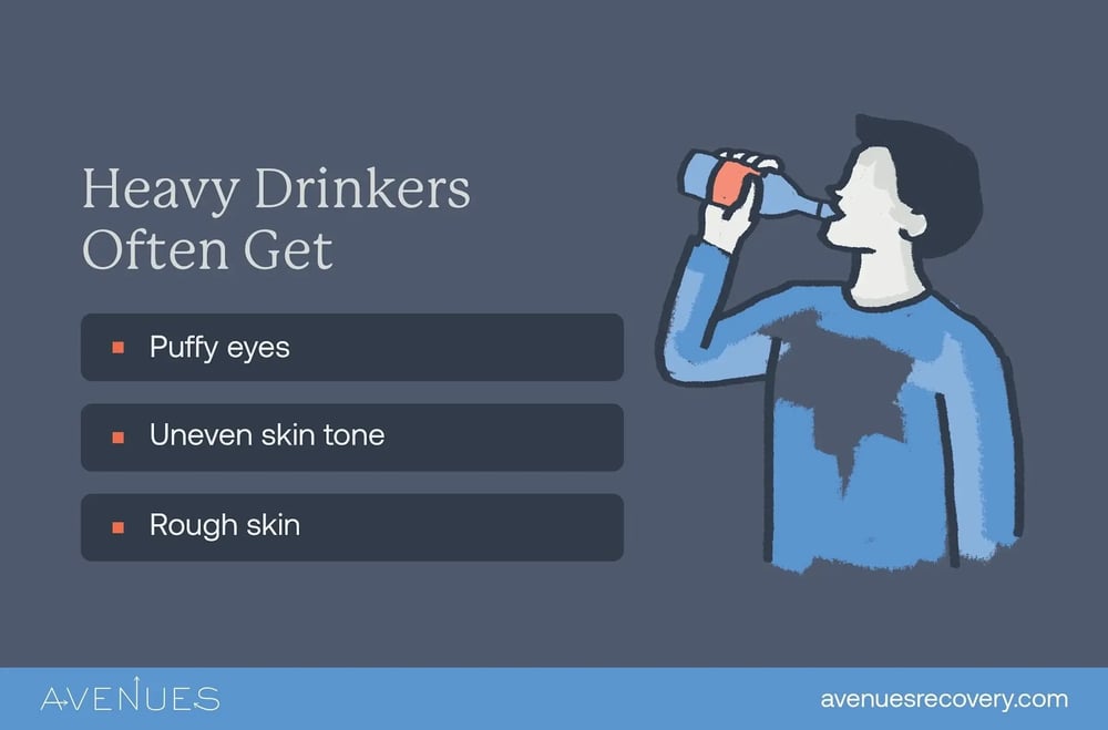 Avenues Recovery infographic depicting in what ways alcohol affects heavy drinkers’ skin