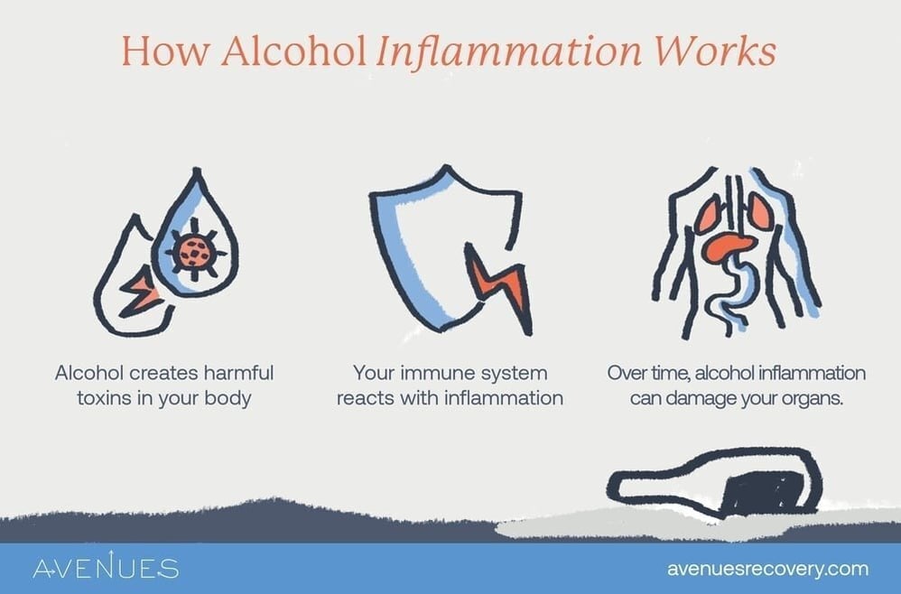 Illustration showing the triggers of alcohol inflammation and how it damages organs over time.