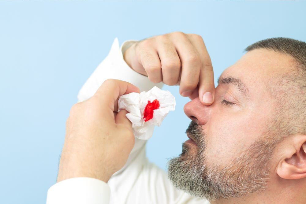Nose Bleed, sign of cocaine abuse