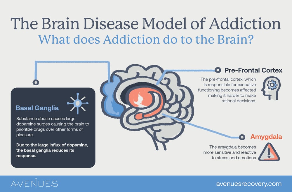 infographic explaining addiction's effects on the brain, based on the disease model of addiction
