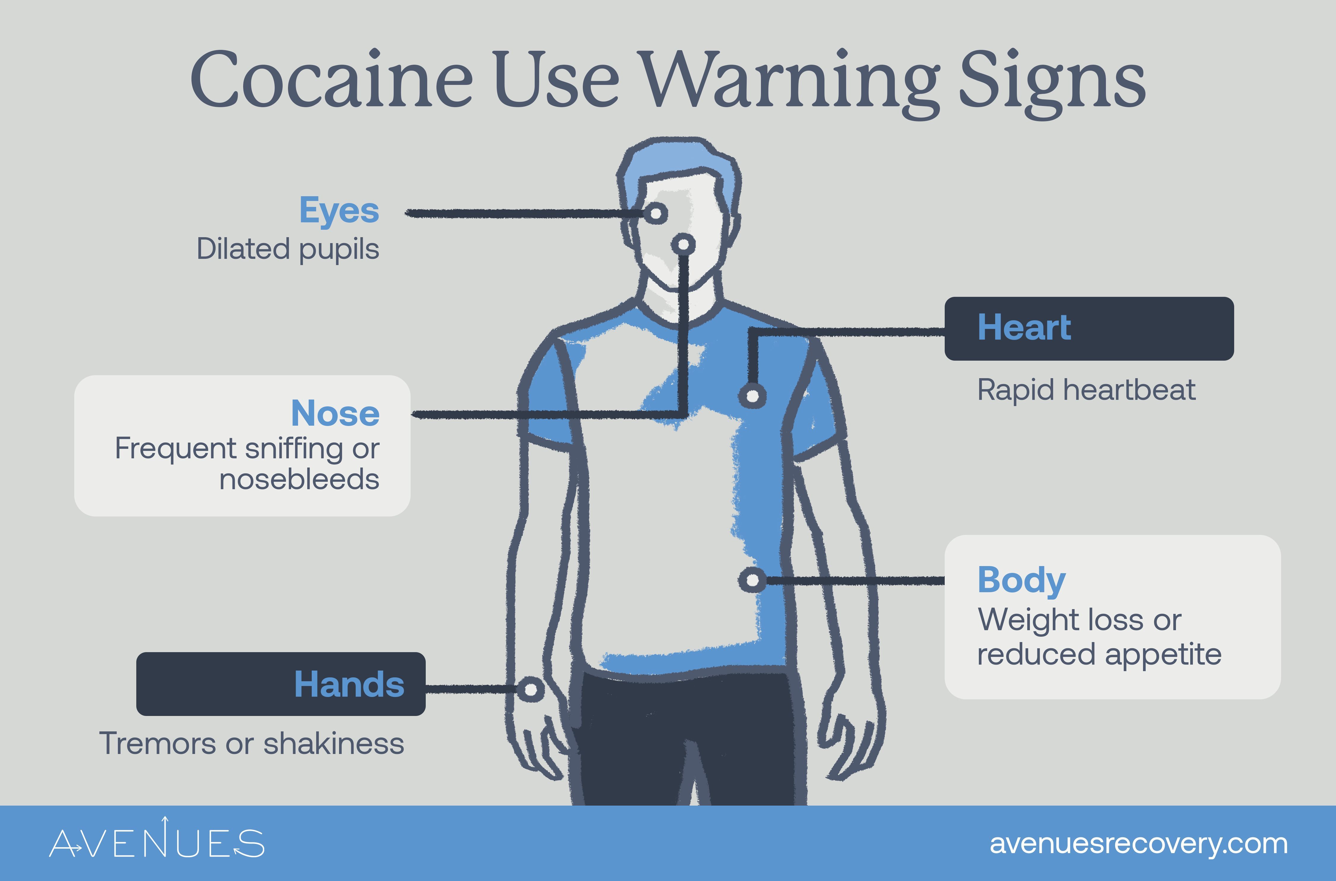 Infographic of cocaine use symptoms as Avenues Recovery explores signs of cocaine use