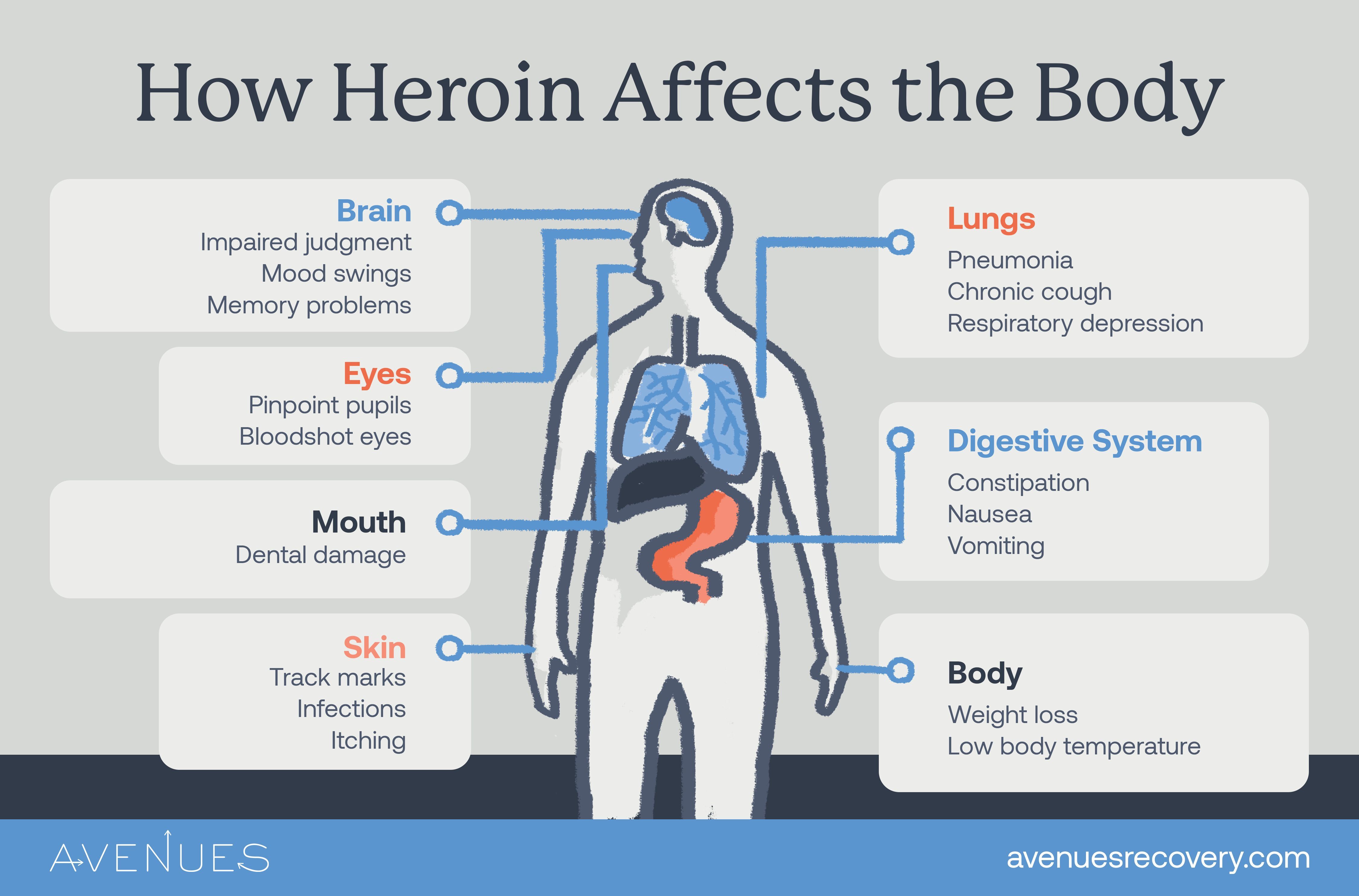 Infographic of how heroin affects the body as Avenues Recovery explores heroin symptoms