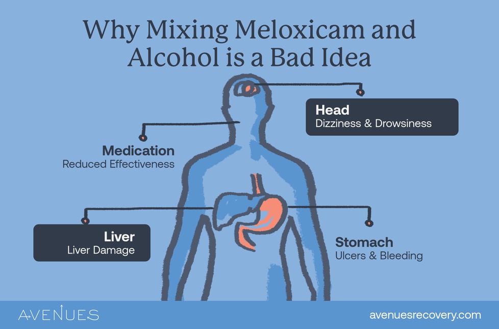 Infographic of mixing Meloxicam and Alcohol as Avenues Recovery explores mixing Meloxicam and Alcohol