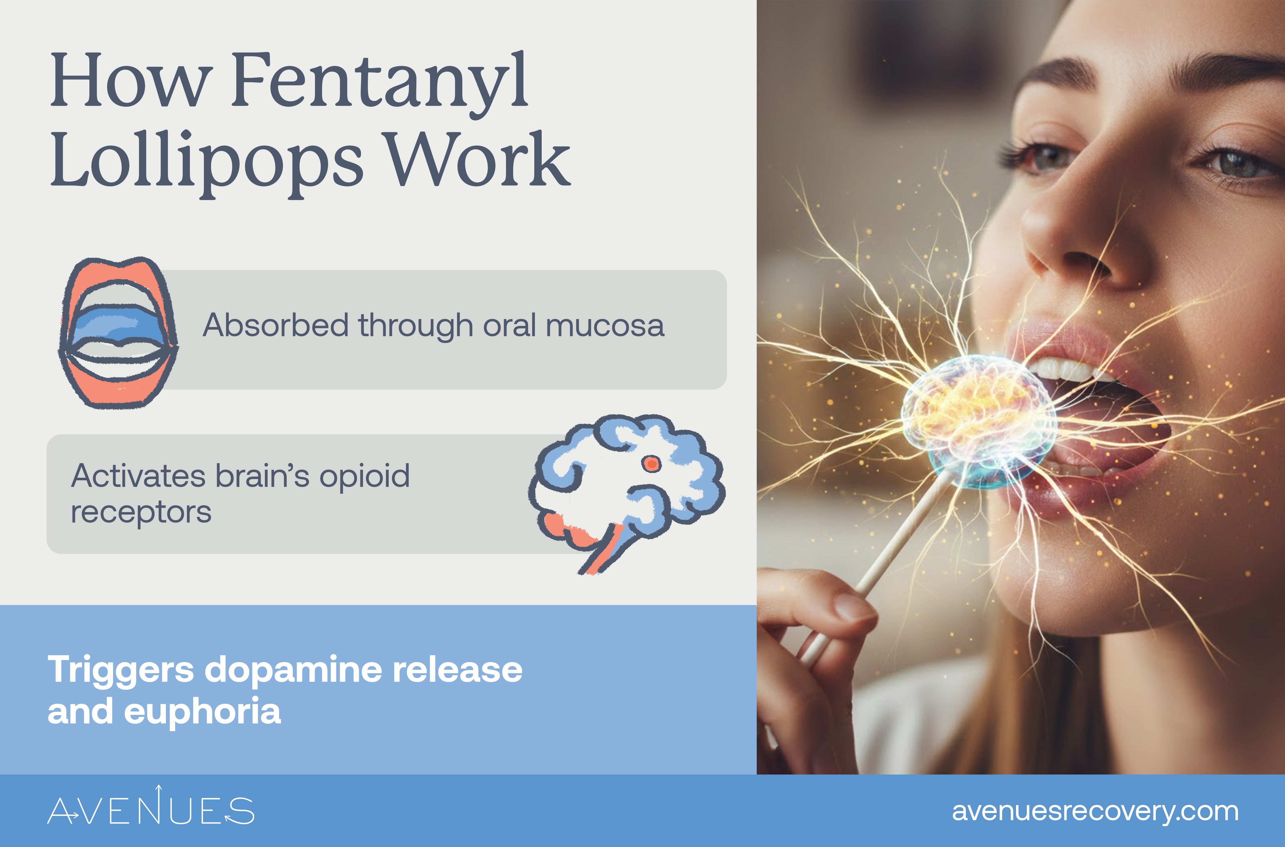 Infographic on how fentanyl lollipops work as Avenues explores Fentanyl lollipops