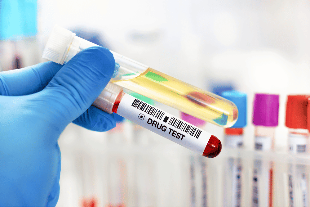 How long does Benadryl stay in your system? Urine and blood times differ, Avenues Recovery explains.