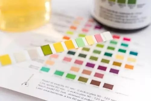 Drug test cup representing monitoring and treatment support with Suboxone for opioid addiction
