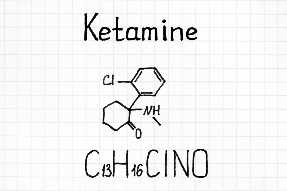Avenues Recovery explains the effectiveness of infusing ketamine for addiction