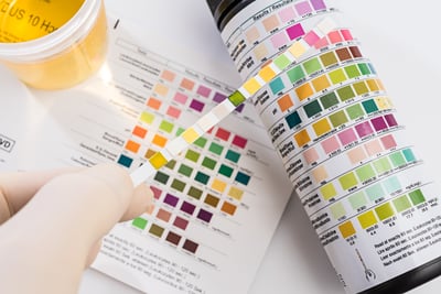 How Long Does Heroin Stay in Your System?