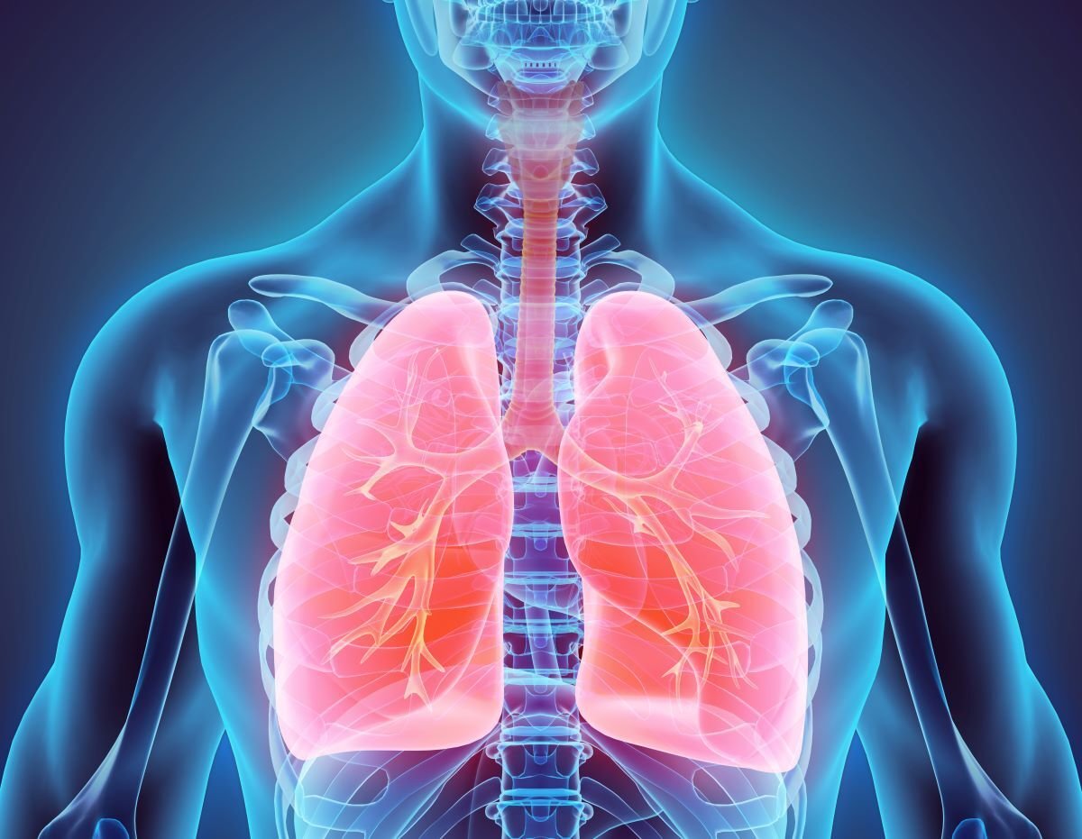 X-ray image of lungs as Avenues Recovery explores "Does smoking weed cause lung cancer?"