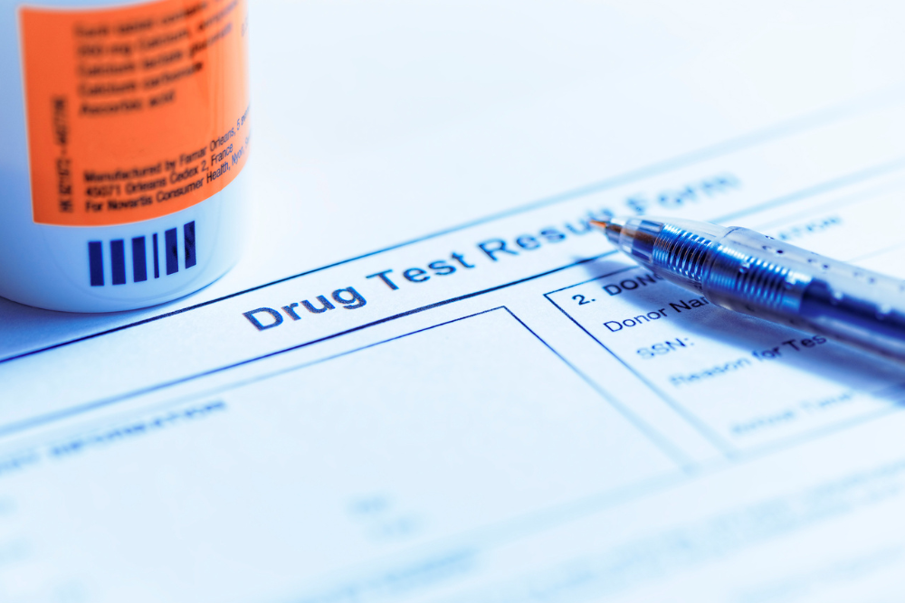 Avenues Recovery explores how long Flexeril stays in your system and its appearance on drug tests.