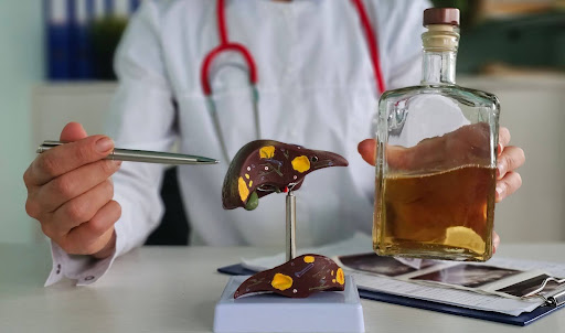 Doctor holding bottle of alcohol, pointing to a liver, explaining that Wellbutrin and alcohol can affect the liver.
