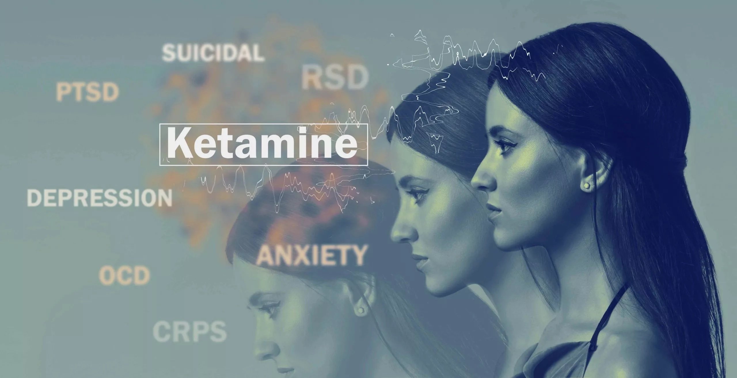 Integrated Dual Disorder Treatment (IDDT) In Addiction Recovery